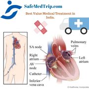 Vertebroplasty cost in India-SafeMedTrip